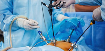 Bariatric Surgery